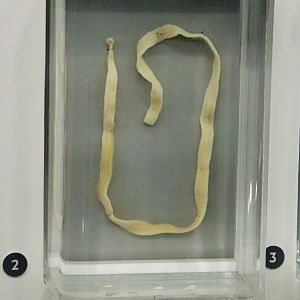 Tapeworm (Bothridium sp.)