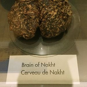 Egypt: Brain of Nakht