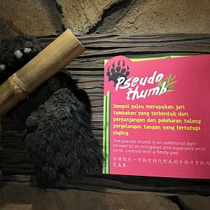 Pseudo Thumb Sign - Giant Panda Complex