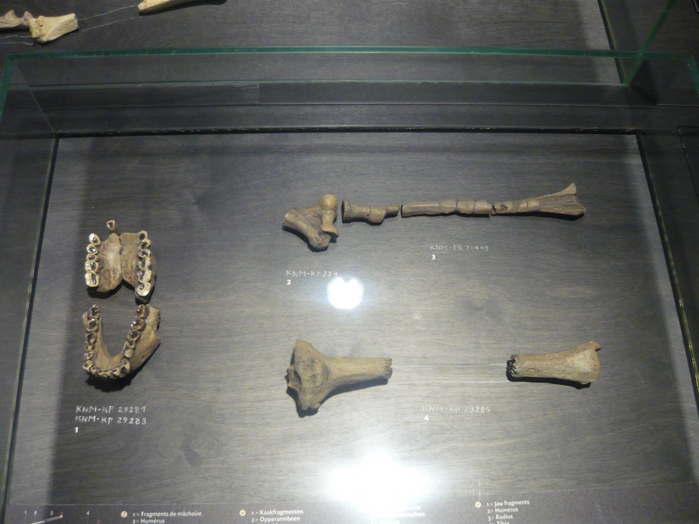 Australopithecus anamensis
