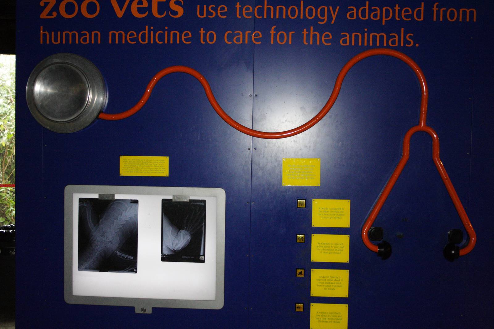 casson inside/outside