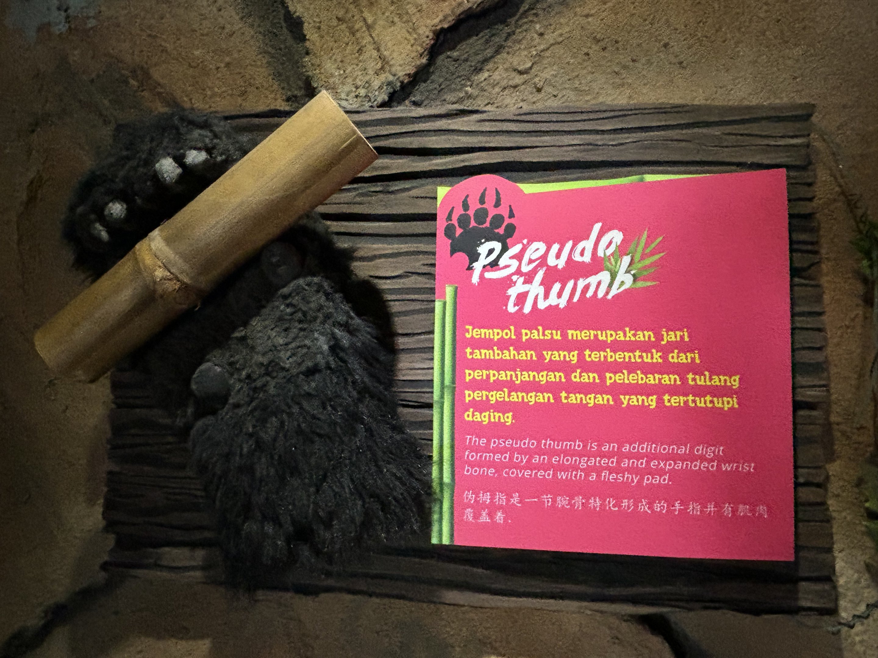 Pseudo Thumb Sign - Giant Panda Complex